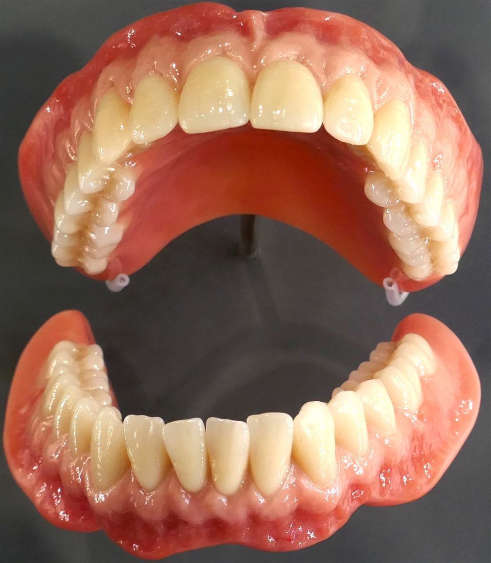 A complete upper and lower denture set